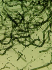 Microscopic View of Fungal Spores Cluster