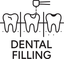 dental filling illustration