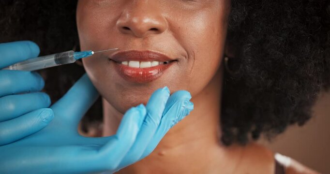 Beauty, lip filler and syringe with mouth of black woman in studio for antiaging or plastic surgery. Face, hands of surgeon and needle with happy person in clinic for cosmetic procedure closeup