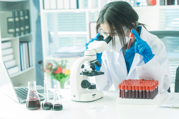 Researcher's hand holding blood vessel. Examination of blood vessel in research laboratory. Blood...