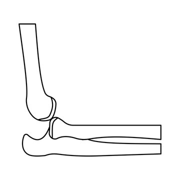 elbow dislocation