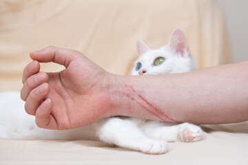 飼い主の腕の引っ掻き傷と犯人の猫