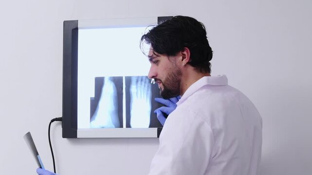  man doctor  examining foot leg X-ray on negatoscope, medical professional analyzing radiograph image of lower limb injury, orthopedic diagnosis, hospital healthcare concept, radiology scene in clinic
