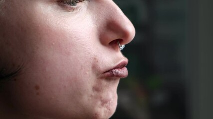 Girl with braces removing food with fingers and tongue, close-up of awkward real moment with dental braces.