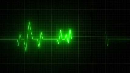 Cardiogram heartbeat pulse neo video animation. Emergency ekg monitoring motion graphics. Animated Abstract green heartbeat loop video footage. seamless loop pulse. - Powered by Adobe