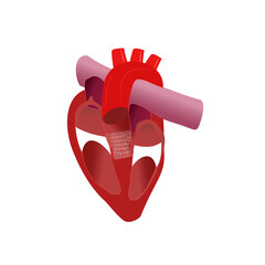 Cardiac model of Transcatheter aortic valve implantation
( TAVI )