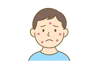 Illustration of a Man Troubled by Acne