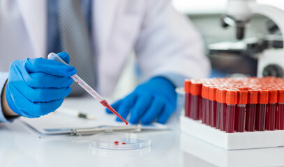 Scientist analyzing blood sample in modern laboratory. Scientist wearing gloves is using a pipette to analyze a blood sample in a petri dish.
