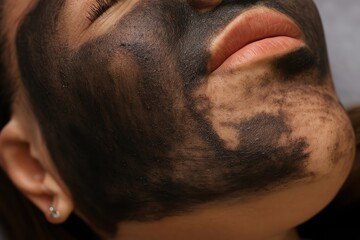 Obraz premium Extreme close-up of a woman’s face with a partially dried charcoal facial mask, revealing skin texture and areas where the mask has thinned. 