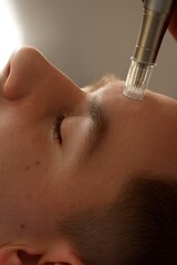 Close-up of a microneedling session on a man’s forehead using a professional dermapen device. The man’s eyes are closed, and the skin is clean and well-lit.
