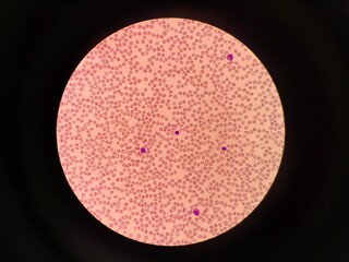 Microscopic View of Red Blood Cells in Vivid Detail