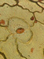 Microscopic View of Portulaca Oleracea Leaf Epidermis