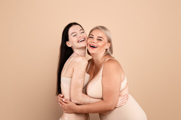 Portrait Of Two Happy Body Positive Women In Underwear Embracing And Laughing Together, Plus Size Lady And Female With Vitiligo Skin Disorder Posing Over Beige Studio Background, Copy Space