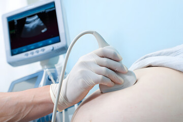 Pregnant woman undergoing ultrasound examination