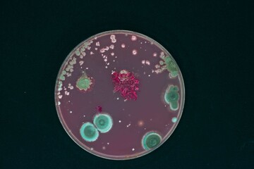 Diverse bacterial colonies growing on agar medium in a petri dish for microbiological research