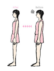 若い女性のビフォーアフター イラスト　ダイエット