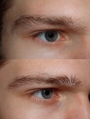 Fototapeta premium Close-up before-and-after of men’s eyebrows shaped and cleaned up, with minimal styling.