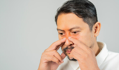 Sinusitis, headache or distress, handsome adult man suffering from sinusitis, puts his fingers on...
