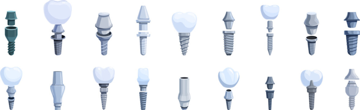 Abutment icons set. Set of dental implants showing different stages and types of artificial tooth roots, restoring teeth functionality and providing a foundation for replacement teeth