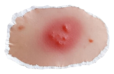 PNG Detailed textured skin patch with visible blemishes.