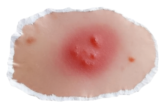 PNG Detailed textured skin patch with visible blemishes.