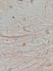 Sperm Cells Stained with Safranin Under Microscope