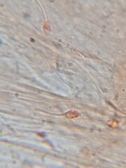 Sperm Cells Stained with Safranin Under Microscope