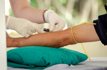 Close up nurse pricking needle syringe in the arm patient drawing blood sample for blood test , Health check