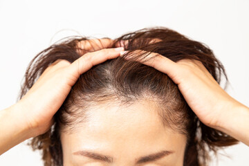 Naklejka premium 生え際を気にするミドル女性 