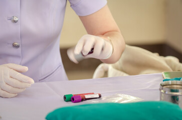 Blurred motion of nurse hand wearing white medical gloves shaking blood vessel for examining or performing PRP procedure. Concept of laboratory research, medicine, analysis.