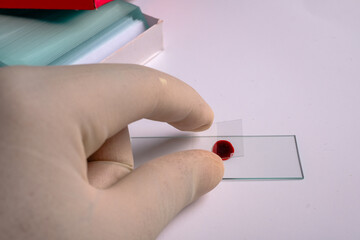 Preparing blood smear on slide for microscopic examination