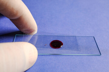Preparing blood smear on slide for microscopic examination