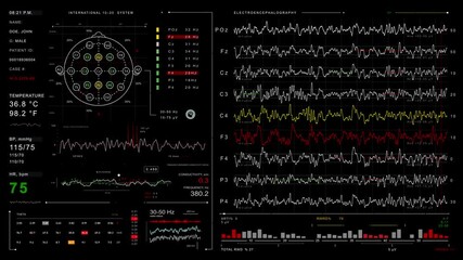Detailed Electroencephalography Displaying Brainwave Activity and Patient Data on Black Background - Powered by Adobe
