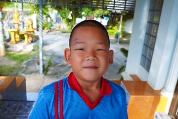 The boy smiled proudly at his face, which was scarred by his mischief.