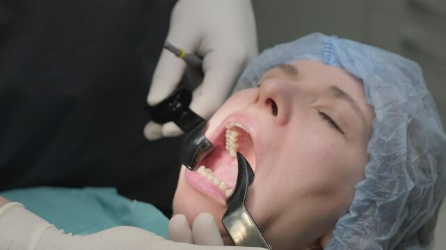 Dental professional uses mouth prop to keep patient mouth open during procedure. Woman wearing surgical cap undergoes dental treatment in hospital