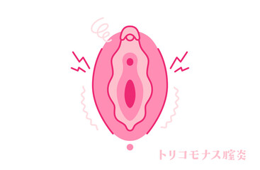 トリコモナス膣炎のある女性器（外陰部）