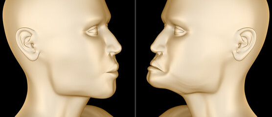 Mandibular Jaw, bone recession after losing teeth. Вental 3D illustration