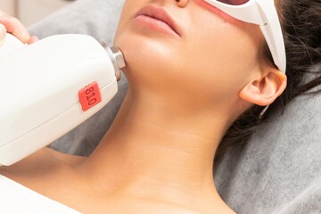Close-up of a woman undergoing upper lip laser hair removal with a professional 810 nm diode laser...