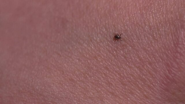 A dangerous tick crawls on the skin of a hand close up. An encephalitis tick is looking for a place to bite. A blood sucking insect and blood poisoning