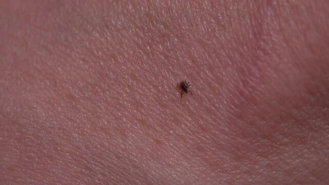 A dangerous tick crawls on the skin of a hand close up. An encephalitis tick is looking for a place to bite. A blood sucking insect and blood poisoning