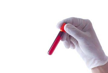 Gloved hand holding a blood sample test tube