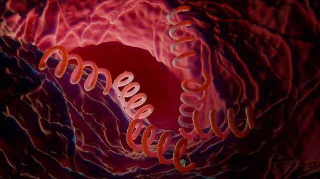 Treponema pallidum: The Syphilis-Causing Bacterium