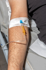 A man arm with an IV drip. An IV catheter in a man's arm. Intravenous administration of drugs using an infusion system.