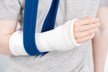 Broken Arm in White Cast and Blue Sling