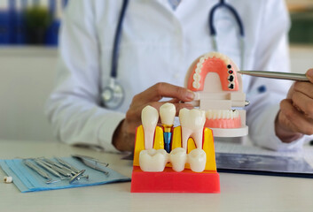 Dental professional demonstrating oral health techniques with educational models