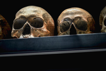 Anatomical display of skulls