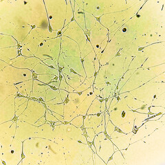 Human glioma cells.