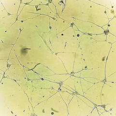 Human glioma cells.