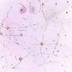 Human glioma cells.