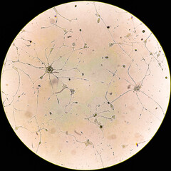 Human glioma cells.